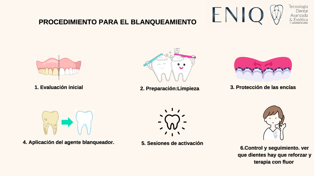 Proceso de blanqueamiento dental
