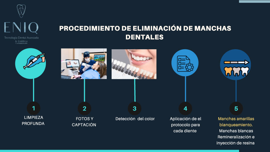 Tratamiento dental en ENIQ