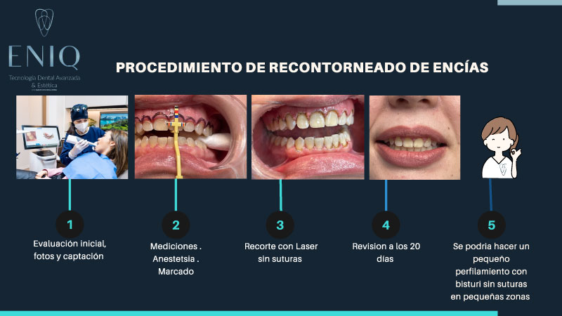 Tratamiento dental en ENIQ